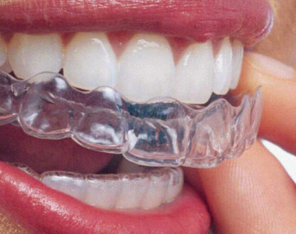 How to Make Invisalign More Comfortable