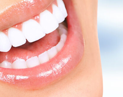Is Professional Teeth Whitening For You? 